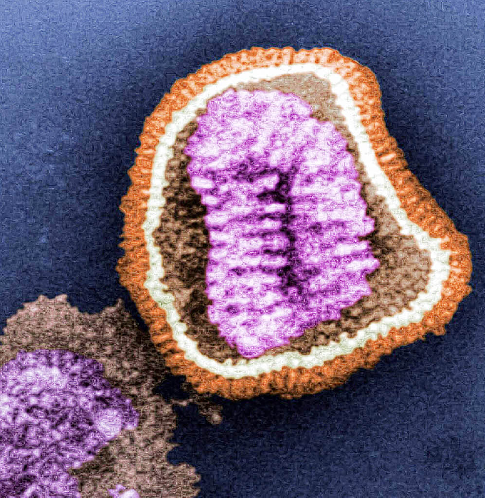 Bildung & Wissen Virus der Spanischen Grippe gibt bis heute Rätsel auf