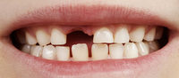 Dr. dents Lückenbüßer Dr. dents Lückenbüßer