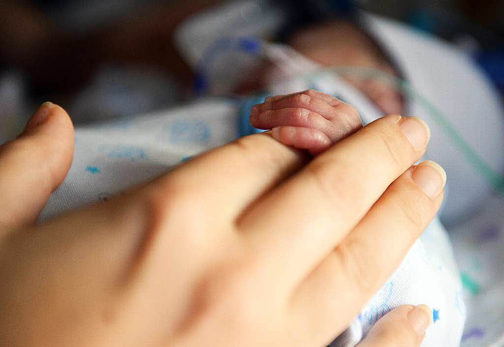 Das Modell mit der Pigmentation von der Haut