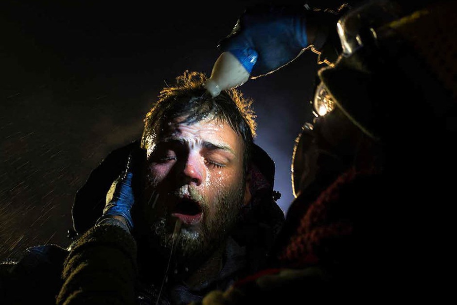 Amber Bracken fotografierte in derselben Reihe außerdem einen Mann, der mit Magnesiummilch behandelt wird, nachdem er am 21. November 2016 bei einer Blockade des Highway 1806 in Cannon Ball, North Dakota, USA von der Polizei mit Pfefferspray angegriffen worden ist. (Foto: dpa) Amber Bracken fotografierte in derselben Reihe außerdem einen Mann, der mit Magnesiummilch behandelt wird, nachdem er am 21. November 2016 bei einer Blockade des Highway 1806 in Cannon Ball, North Dakota, USA von der Polizei mit Pfefferspray angegriffen worden ist. (Foto: dpa)
