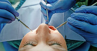 34 000 Euro für unbrauchbare Implantate 34 000 Euro für unbrauchbare Implantate