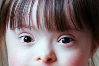 Down-Syndrom: Wie Eltern gegen die Stigmatisierung ihrer Kinder kämpfen Down-Syndrom: Wie Eltern gegen die Stigmatisierung ihrer Kinder kämpfen
