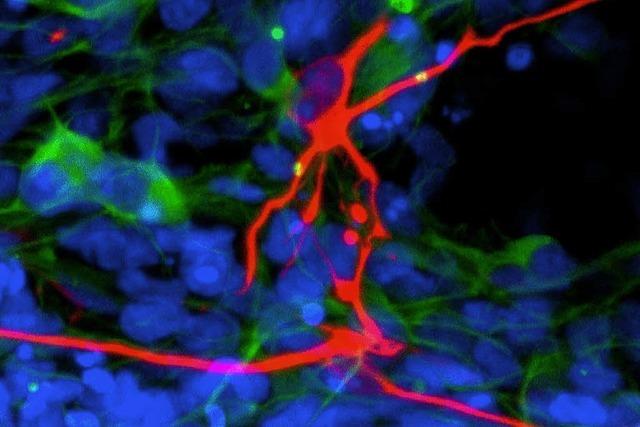 Neue Nerven aus Hautzellen