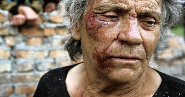 Verwundete Frau in Sd-Ossetien: Dieses dpa-Foto verffentlichte die BZ. 