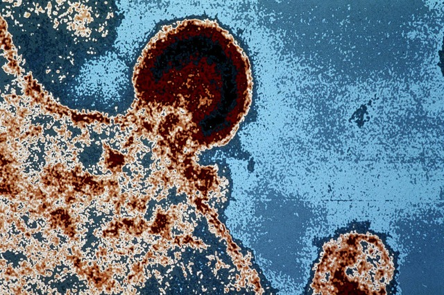HIV wie es Luc Montagnier einst sah: D...verlsst eine geenterte  Abwehrzelle.   | Foto: afp
