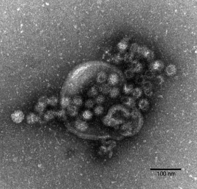Das Norovirus unter dem Elektronenmikroskop.  | Foto: ddp