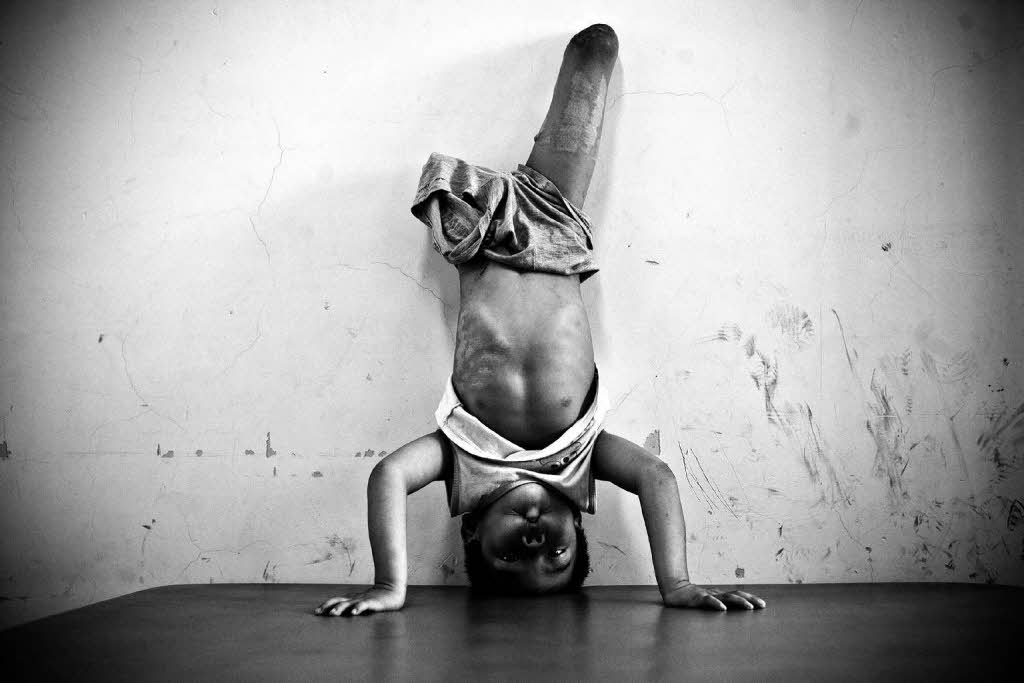 Li Yaohua (5 Jahre) macht im Rehazentrum in Chengdu in der chinesischen Provinz Sichuan einen Handstand.