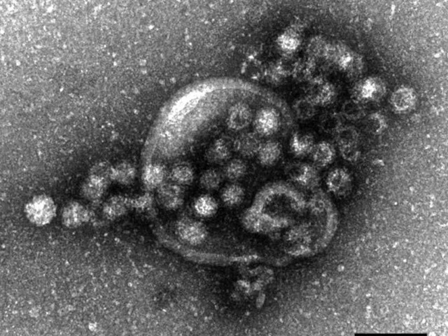 So sieht der Norovirus unter dem Mikroskop aus.  | Foto: ddp