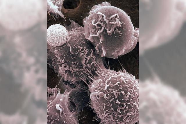 Eine Frischzellenkur gegen den Krebs