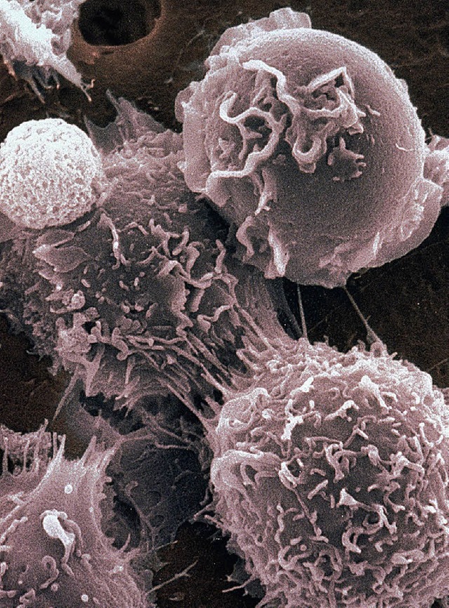 Stammzellen aus dem Knochenmark  | Foto: okapia
