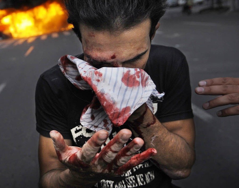 Niedergeschlagen:   Ein verletzter Anhänger Mir Hossein Mussawi   in Teheran.     | Foto: AFP
