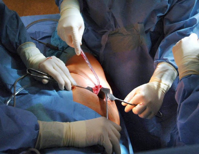 Anwalts Liebling:  Chirurgen bei  einer Hft-OP  | Foto: dpa/BZ/FOTOLIA