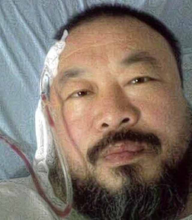 Dieses Handyfoto vom  Krankenbett  stellte Ai Weiwei ins Netz.    | Foto: bz