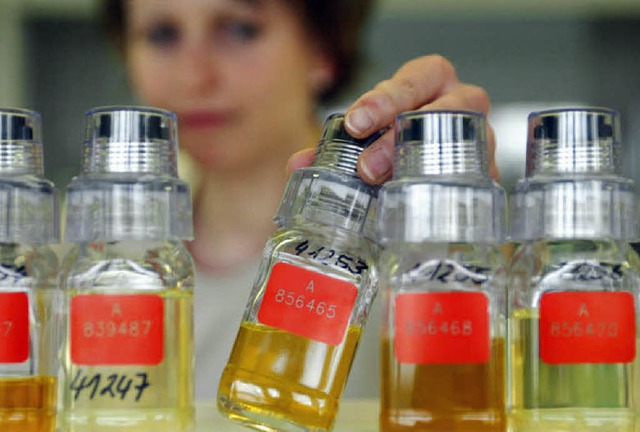 Fr manche Firmen ein goldener und gewinnversprechender   Saft: Urin im  Labor   | Foto: ddp