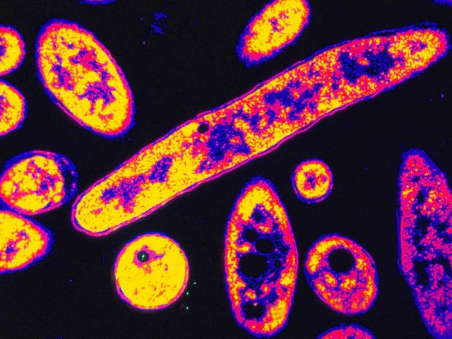 Legionellen-Bakterien: Infektionen beginnt meist mit Husten und Fieber.  | Foto: OKAPIA KG, Germany