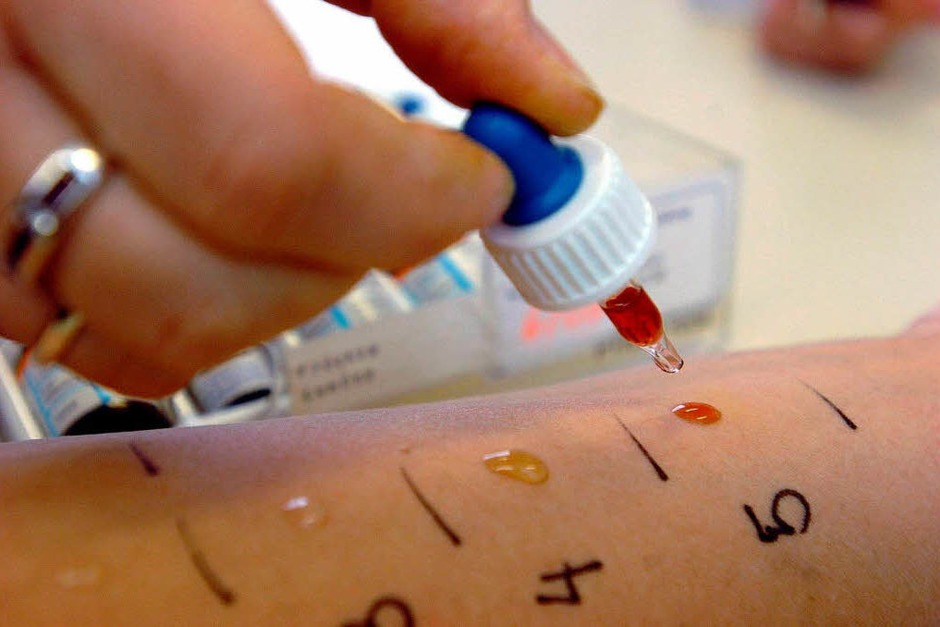 Ein Allergietest zeigt an, auf welche Pollen Menschen reagieren. Den Test sollte ein Facharzt. (Foto: A3591 Peter Roggenthin) Ein Allergietest zeigt an, auf welche Pollen Menschen reagieren. Den Test sollte ein Facharzt. (Foto: A3591 Peter Roggenthin)