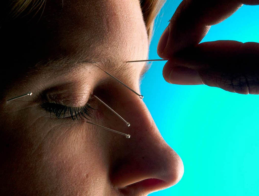 Manchen hilft Akupunktur. Auch Nasenspray, Augentropfen und Tabletten erleichtern die Beschwerden.