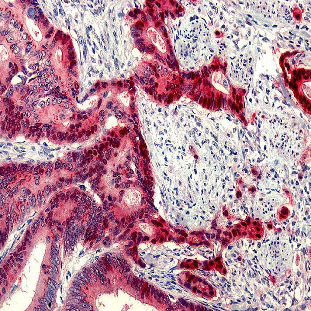 Auf der Fährte des Tumors Bildung & Wissen Badische Zeitung
