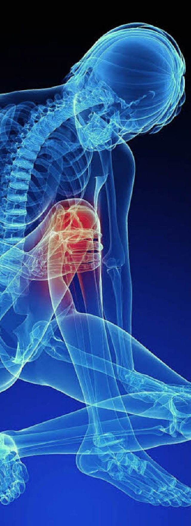Ein Rntgenbild von einem Menschen, de... Knie hlt: Zeit fr ein neues Gelenk?  | Foto: fotolia.com/sebastian kaulitzki
