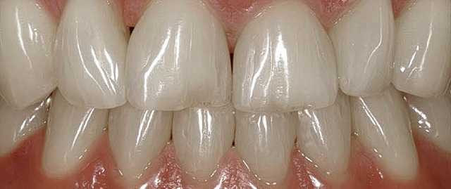 Ausgeschlagenen Zhnen (und ihren Besi... der Zahnrettungsbox geholfen werden.   | Foto: bz