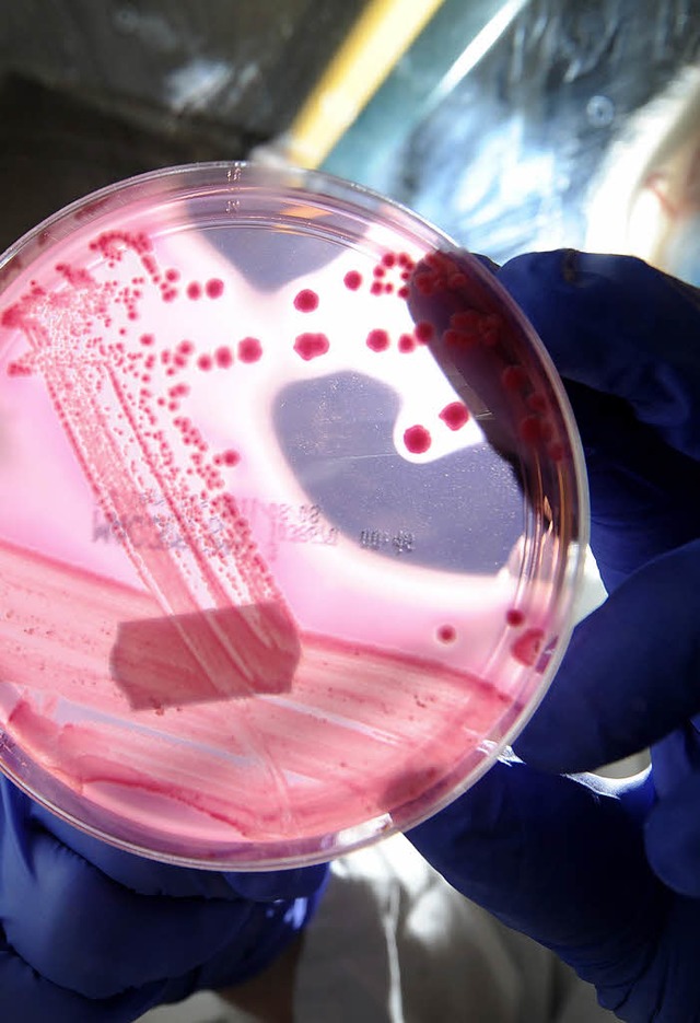 Eine Petrischale mit einem speziellen ...dem Ehec-Bakterienstmme zu sehen sind  | Foto: dpa