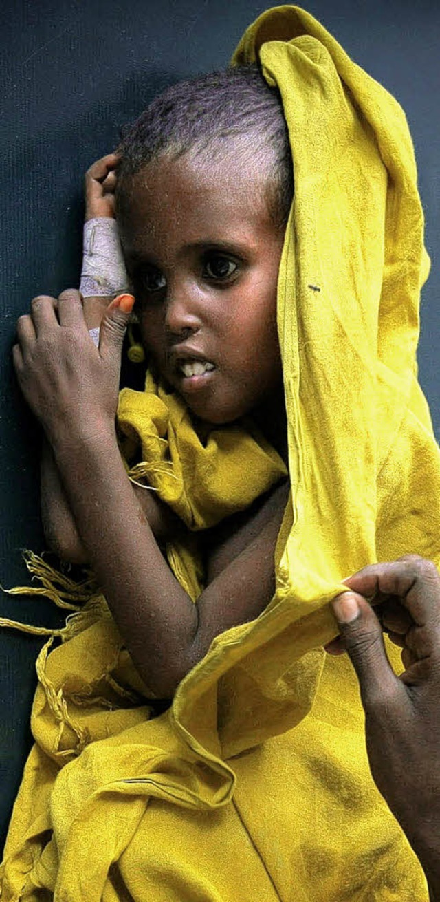 Ein unterernhrtes  Kind in Somalias H...dt Mogadischu im August dieses Jahres   | Foto: dpa