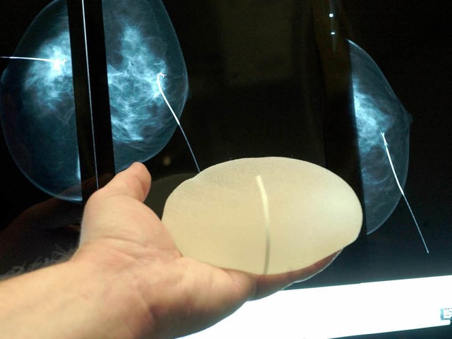 Knnen reien: Brustimplantate des Her... Poly Implant Prothse aus Frankreich.  | Foto: dpa