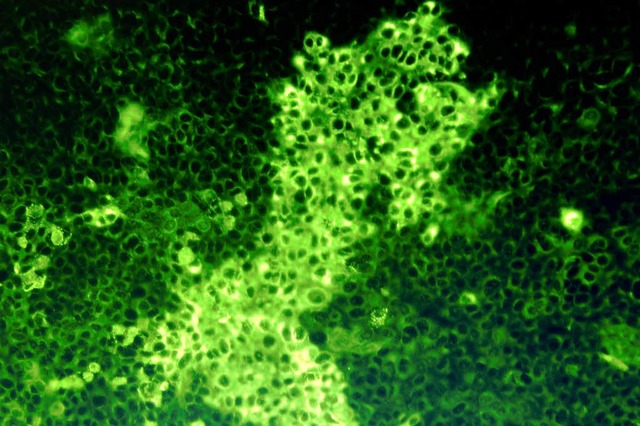 Das Schmallenberg-Virus  | Foto: dpa