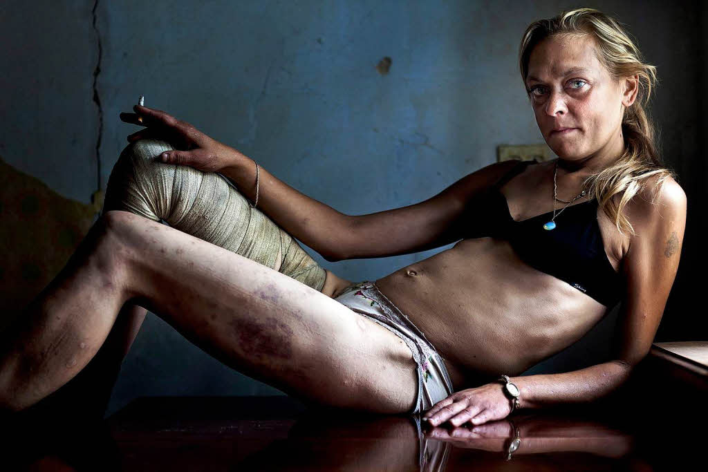 Eine drogenabhngigen Prostituierten in der Ukraine. Brent Stirton, Sdafrika, erhlt  den ersten Preis Contemporary Issues Singles