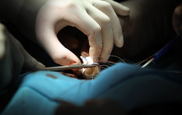 Herzoperation  | Foto: Verwendung weltweit, usage worldwide