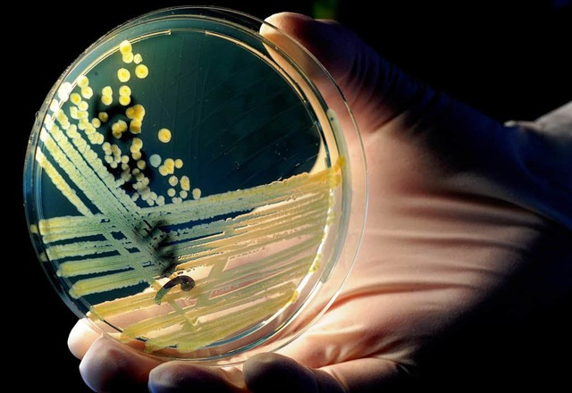 Petrischale mit einem speziellen Nhrb... auf dem Ehec-Bakterien zu sehen sind.  | Foto: dpa