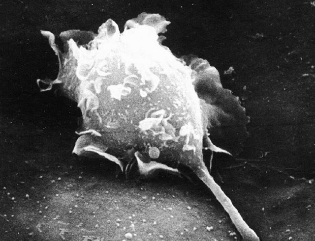 Krebszelle durchbohrt einen Gefwand bei einer Maus  | Foto: dpa