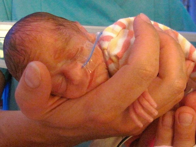 Frhchen Emilia wog bei ihrer Geburt nur 630 Gramm.   | Foto: privat