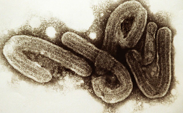 Gegen das Ebola-Virus gibt es kein Heilmittel.  | Foto: dpa
