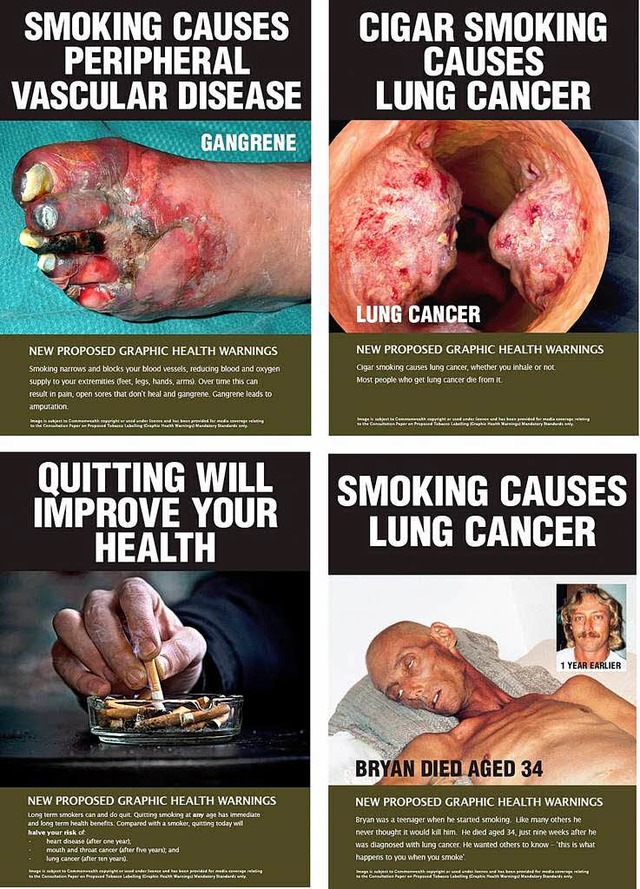 Solche Bilder prangen in Zukunft auf Zigarettenschachteln in Australien.  | Foto: dpa