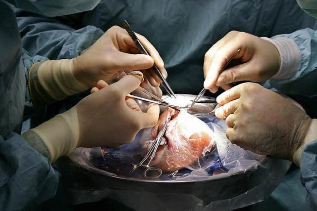 Transplantationssystem in Deutschland insgesamt vertrauenswürdig