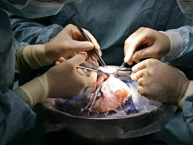 rzte sind dabei, eine Leber zu verpfl...ei Transplantationen soll gering sein.  | Foto: dapd