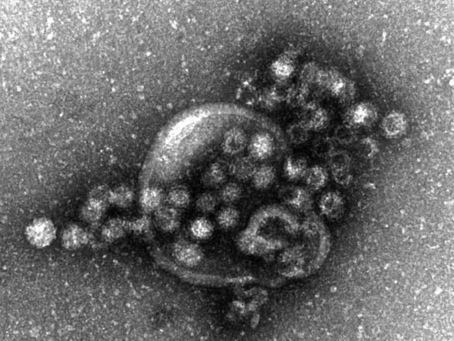 Diese vom Robert-Koch-Institut verffe...rovirus unter dem Elektronenmikroskop.  | Foto: dapd