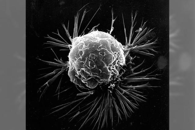 Wissenschaft entziffert Erbgut der wichtigsten Tumore