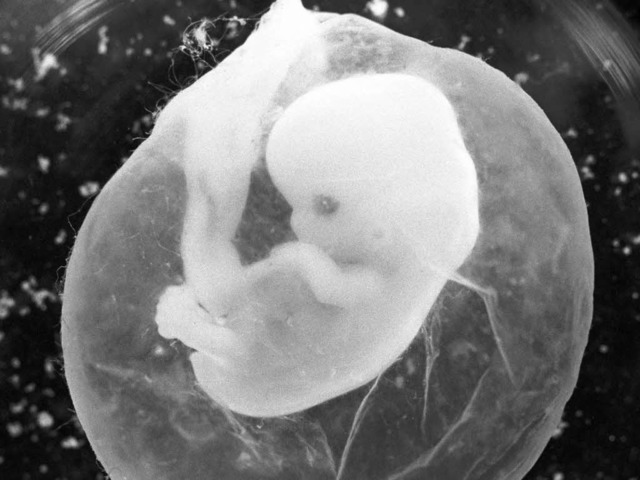 Sieben Wochen alter Ftus in einer Fruchtblase  | Foto: dpa