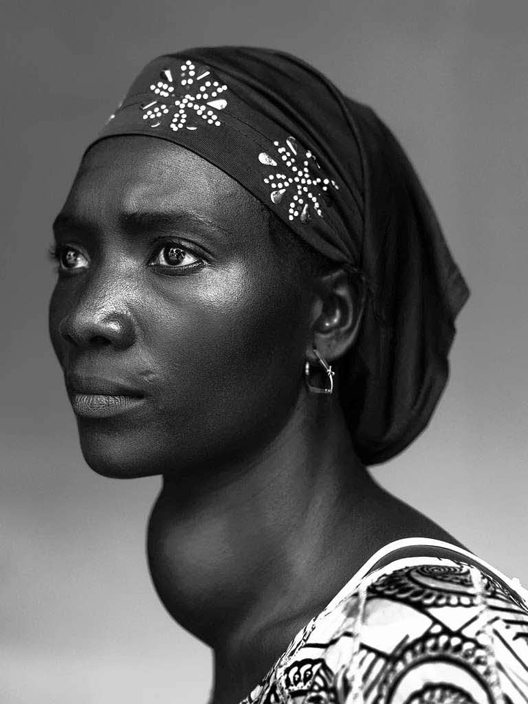 Das beste Portrt machte Stepher Vanfleteren. Es zeigt eine Hausfrau aus Guinea, die mit einem Kropf lebt.