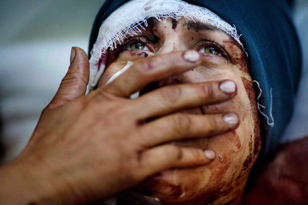 Erster Platz fr Fotograf Rodrigo Abd in der Kategorie „Nachrichten“, fr seine Aufnahme einer verletzten Syrerin.
