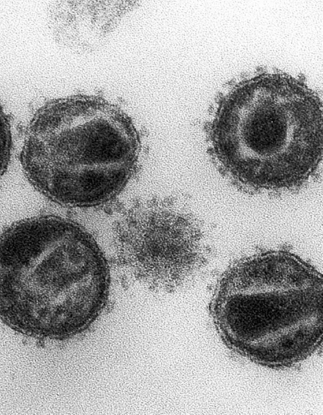 Aids-Immunschwcheviren unterm Mikroskop   | Foto: DPA
