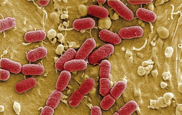 Extrem vergrert: E.coli-Darmbakterien   | Foto: AFP