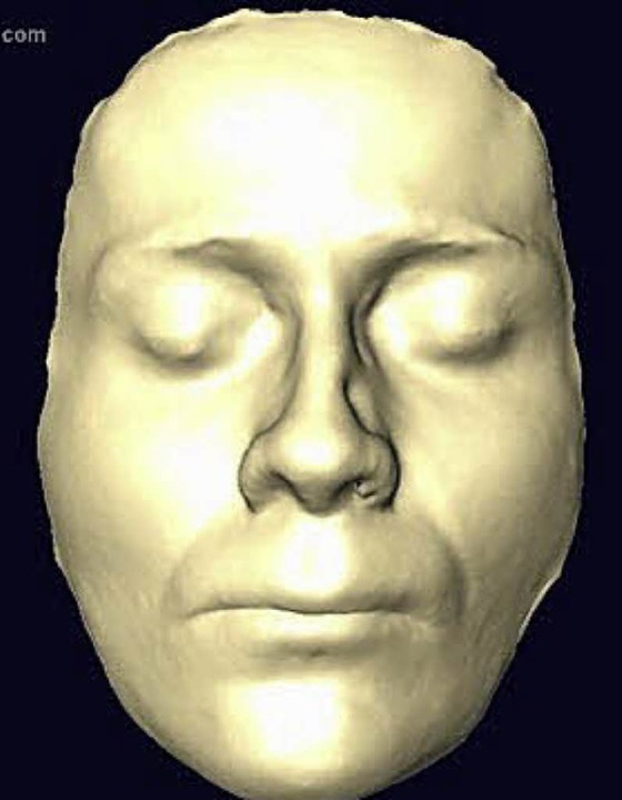 Bjrn Stark Gesichtsabdruck mit 31 Jahren  | Foto: Uniklinik Freiburg