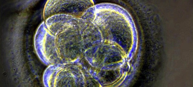 US-Forscher haben aus einem knstlich ...2005)  erstmals Stammzellen gewonnen.   | Foto: dpa