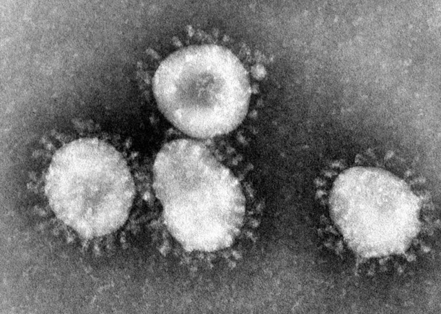 Das Coronavirus  | Foto: dpa