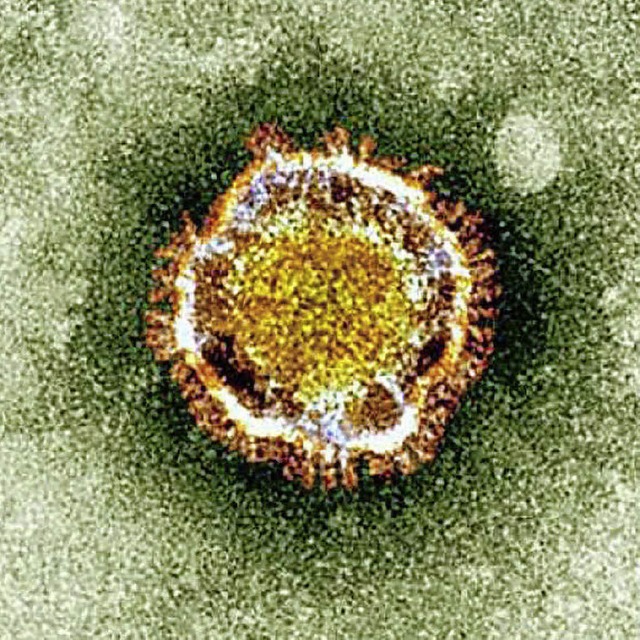Nicht zu unterschtzen: Coronavirus  | Foto: afp
