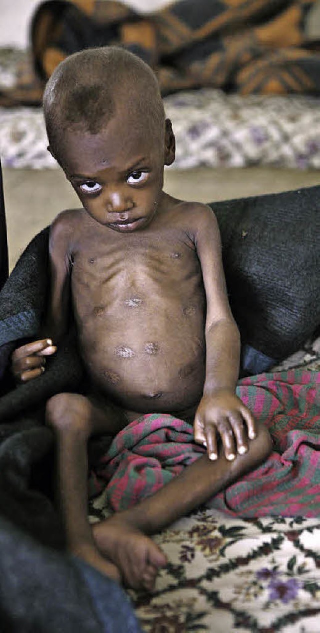 Hunger in thiopien. Dort kommt es immer wieder zu Drren.   | Foto: DPA