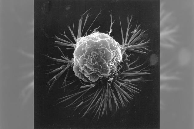 Neuer Ansatz im Kampf gegen Krebszellen